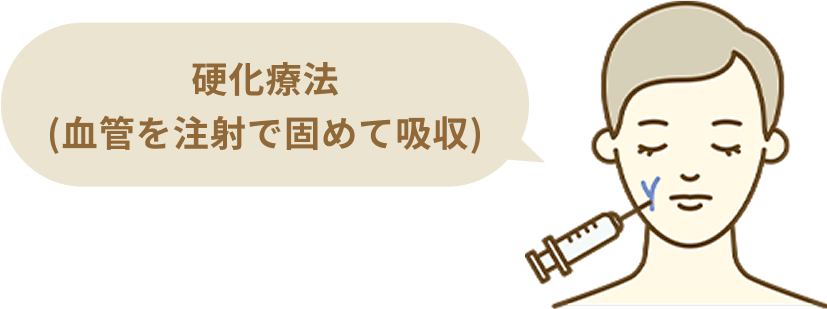 硬化療法(血管を注射で固めて吸収)